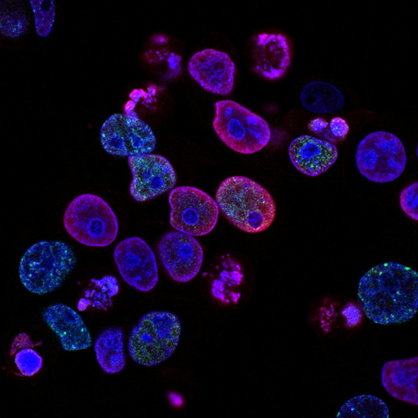 Image of a sample under a fluorescence microscope